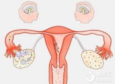 這就卵巢早衰了？中醫(yī)治療如何改善卵巢功能？
