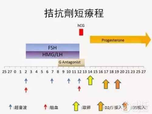 試管拮抗劑方案是什么？醫(yī)生：這些人適合應(yīng)用