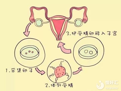 試管嬰兒“回家”過(guò)程你都知道嗎？真相在這里