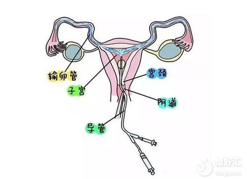 不孕檢查的最佳時間你知道嗎？快看這里